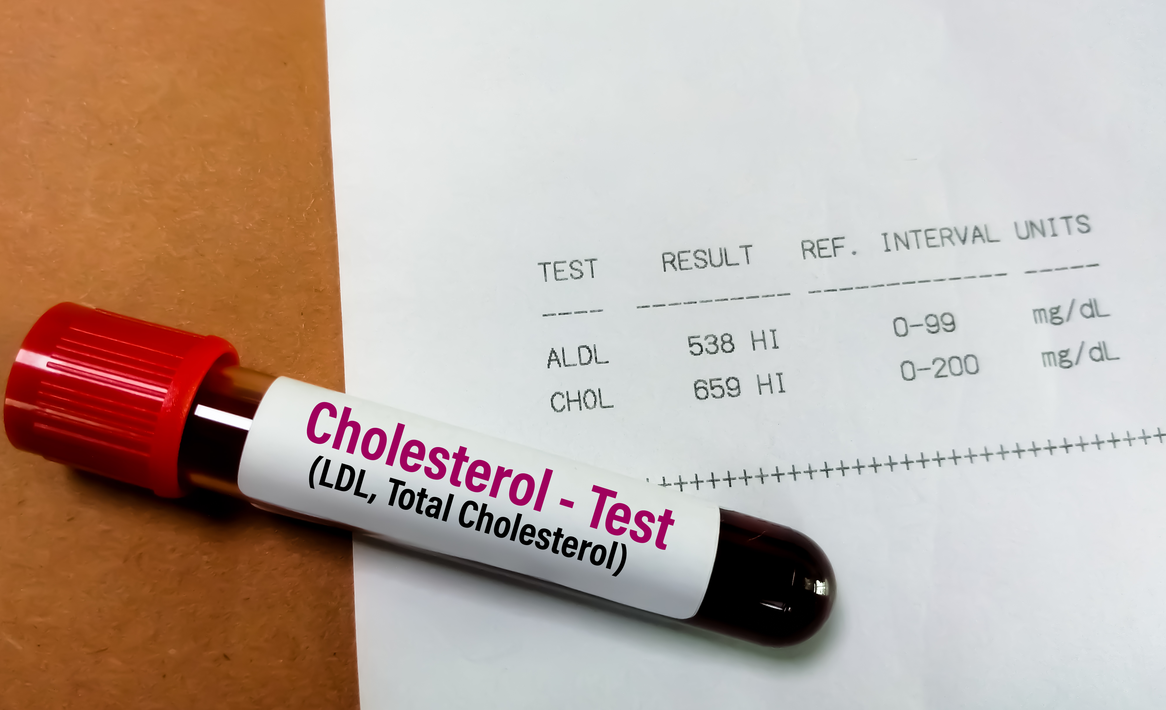 Cara Menjaga Kolesterol dengan 5 Gaya Hidup Ini